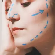 Face in pre-surgery