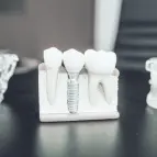 Dental implant